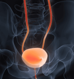 Bladder Surgery